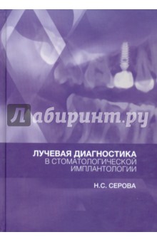 Лучевая диагностика в стоматологической имплантологии. Атлас