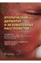 Атопический дерматит и экзематозные расстройства