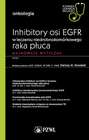Onkologia. Inhibitory osi EGFR w leczeniu niedrobnokomórkowego raka płuca
