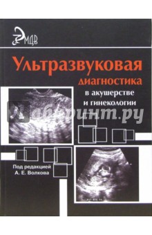 Ультразвуковая диагностика в акушерстве и гинекологии. Практическое руководство.