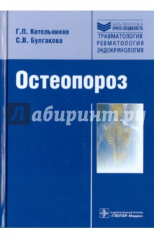 Остеопороз