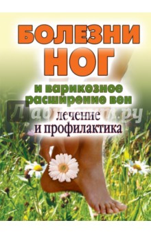Болезни ног и варикозное расширение вен