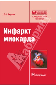 Инфаркт миокарда: руководство