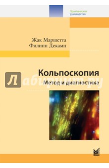 Кольпоскопия. Метод и диагностика