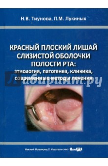 Красный плоский лишай слизистой оболочки полости рта (этиология, патогенез, клиника, современные мет
