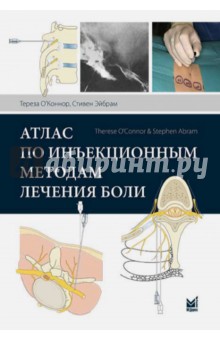 Атлас по инъекционным методам лечения боли