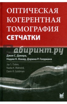 Оптическая когерентная томография сетчатки