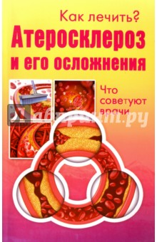 Как лечить? Атеросклероз и его осложнения. Что советуют врачи
