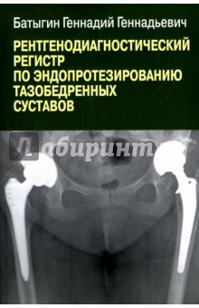 Рентгенологический регистр по эндопротезированию тазобедренных суставов