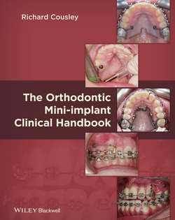 The Orthodontic Mini-implant Clinical Handbook