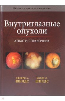 Внутриглазные опухоли. Атлас и справочник