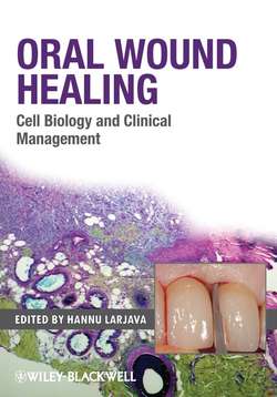 Oral Wound Healing. Cell Biology and Clinical Management