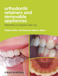 Orthodontic Retainers and Removable Appliances. Principles of Design and Use