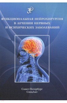 Функциональная нейрохирургия в лечении нервных