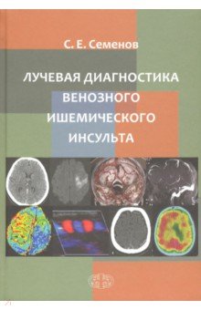 Лучевая диагностика венозного ишемическог инсульта