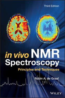 In Vivo NMR Spectroscopy. Principles and Techniques