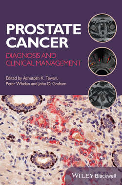 Prostate Cancer. Diagnosis and Clinical Management
