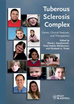 Tuberous Sclerosis Complex. Genes, Clinical Features and Therapeutics
