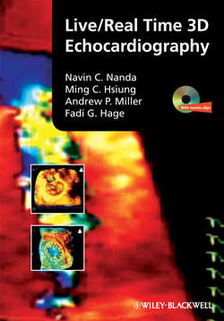 Live/Real Time 3D Echocardiography