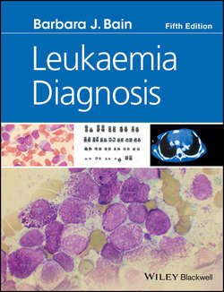 Leukaemia Diagnosis