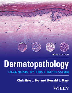 Dermatopathology. Diagnosis by First Impression
