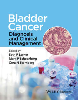 Bladder Cancer. Diagnosis and Clinical Management