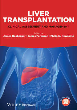 Liver Transplantation. Clinical Assessment and Management