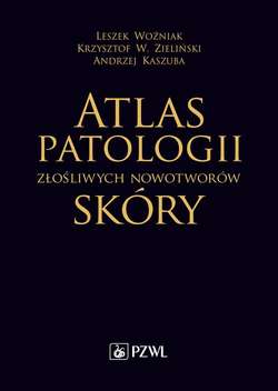 Atlas patologii złośliwych nowotworów skóry