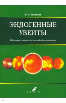 Эндогенные уевиты. Избранные лекции для врачей-офтальмологов