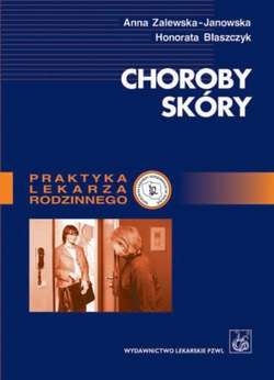 Choroby skóry