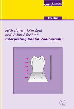 Interpreting Dental Radiographs