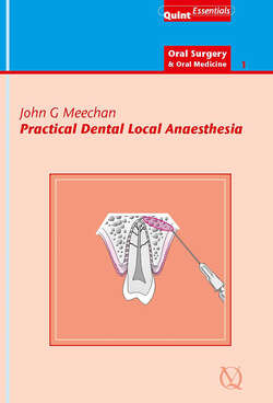 Practical Dental Local Anaesthesia