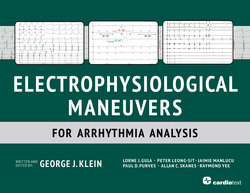 Electrophysiological Maneuvers for Arrhythmia Analysis