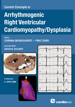 Current Concepts in Arrhythmogenic Right Ventricular Cardiomyopathy/Dysplasia