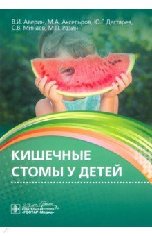 Кишечные стомы у детей. Руководство