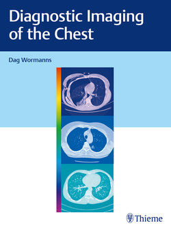 Diagnostic Imaging of the Chest