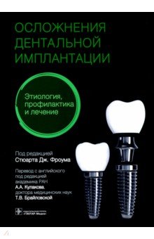 Осложнен.дентальн.имплантац. Этиология, профилакт.