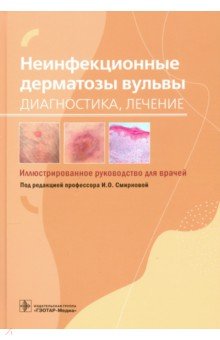 Неинфекционные дерматозы вульвы. Диагностика, лечение. Иллюстрированное руководство