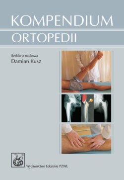 Kompendium ortopedii