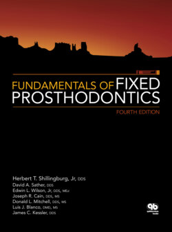 Fundamentals of Fixed Prosthodontics