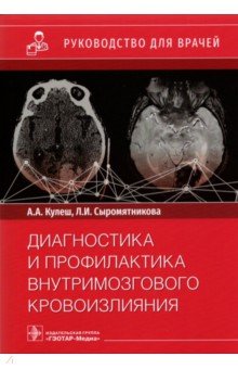 Диагностика и профилактика внутримозгового кровоизлияния. Руководство