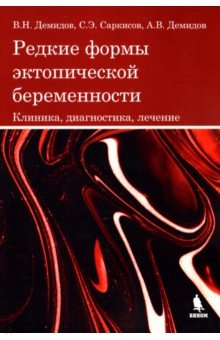 Редкие формы эктопической беременности. Клиника, диагностика, лечение