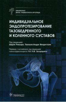 Индивидуальное эндопротезирование тазобедренного и коленного суставов