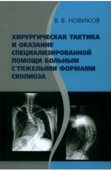 Хирургическая тактика и оказание специализированной помощи больным с тяжёлыми формами сколиоза