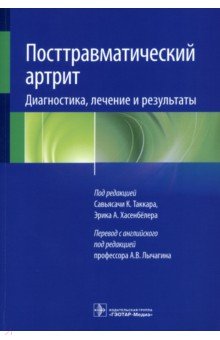 Посттравматический артрит. Диагностика, лечение и результаты