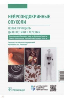 Нейроэндокринные опухоли. Новые принципы диагностики и лечения. Руководство