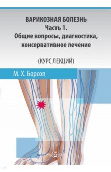 Варикозная болезнь. Часть 1. Общие вопросы, диагностика, консервативное лечение