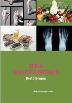 Dna Moczanowa Dietoterapia