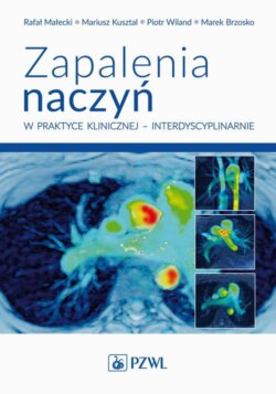 Zapalenia naczyń w praktyce klinicznej interdyscyplinarnie