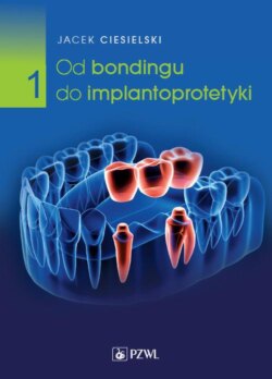 Od bondingu do implantoprotetyki Część 1
